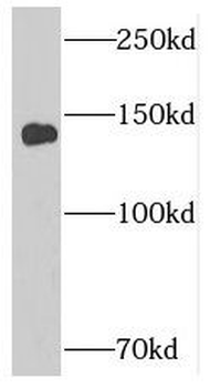 SUPT16H Antibody