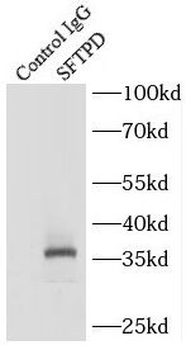 SFTPD Antibody