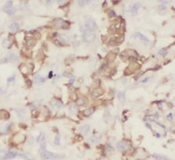 SFTPD Rabbit Polyclonal Antibody