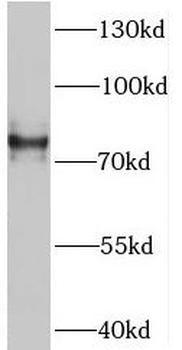 SV2B Antibody