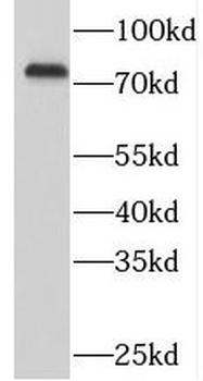 SYK Rabbit Polyclonal Antibody
