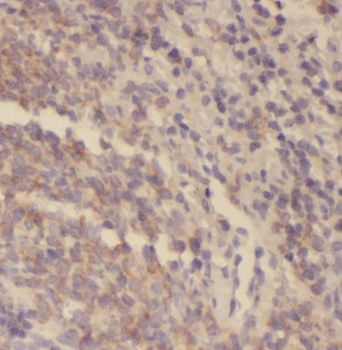 SYK Rabbit Polyclonal Antibody