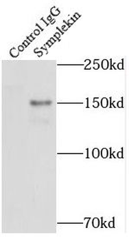 SYMPK Rabbit Polyclonal Antibody