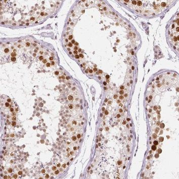 SYMPK Rabbit Polyclonal Antibody