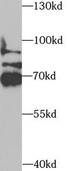 SYNCRIP Rabbit Polyclonal Antibody