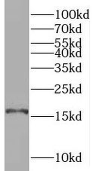 SYNJ2BP Antibody