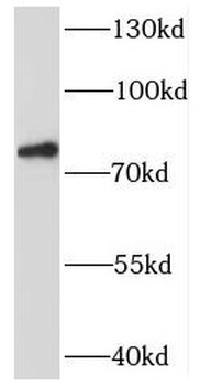 SYT17 Rabbit Polyclonal Antibody