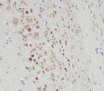 SYT17 Rabbit Polyclonal Antibody