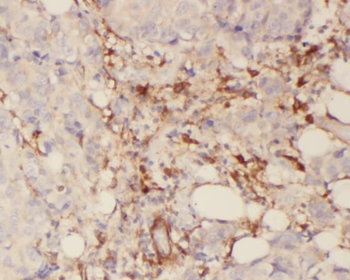 SYTL2 Rabbit Polyclonal Antibody