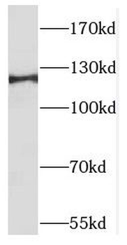 TACC1 Antibody
