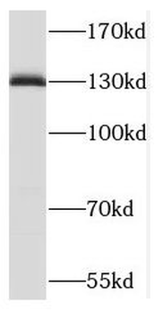 TACC3 Antibody