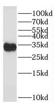 TACO1 Antibody