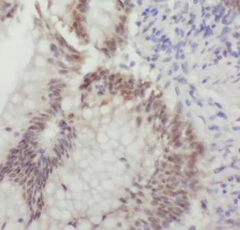 TADA2A Rabbit Polyclonal Antibody
