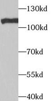 TAF1C Antibody