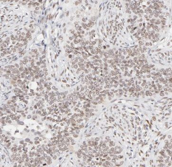TAF7 Rabbit Polyclonal Antibody