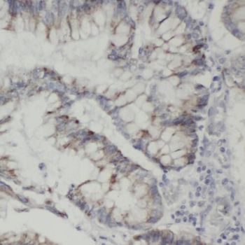 TLN1 Rabbit Polyclonal Antibody