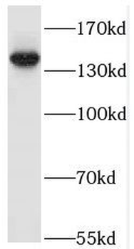 TAOK2 Antibody