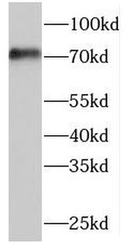 TRIOBP Antibody