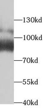 TARS1 Rabbit Polyclonal Antibody
