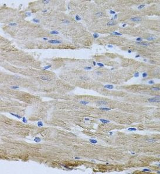 TARS1 Rabbit Polyclonal Antibody