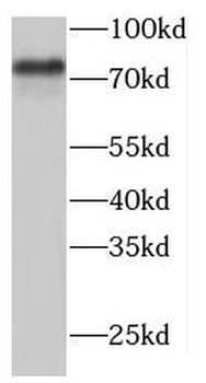TARS2 Antibody