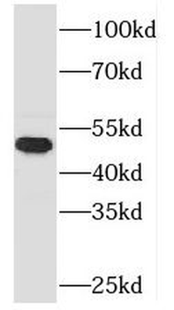 TASP1 Rabbit Polyclonal Antibody