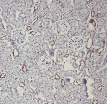 TASP1 Rabbit Polyclonal Antibody