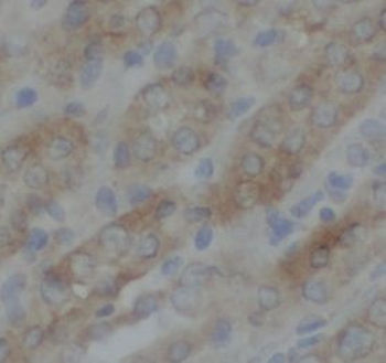 TAX1BP1 Rabbit Polyclonal Antibody