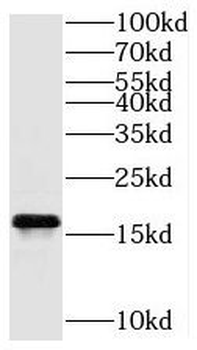 TAX1BP3 Antibody