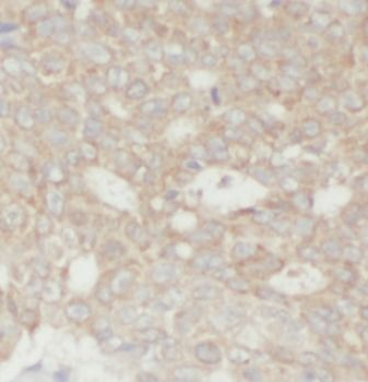 WWTR1 Rabbit Polyclonal Antibody
