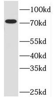 TBC1D17 Antibody