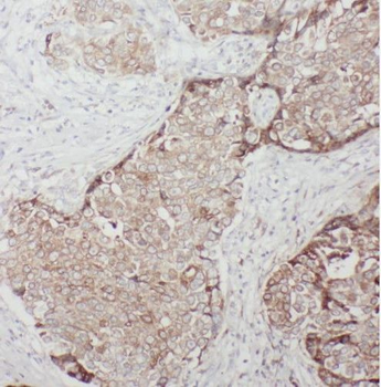 TBC1D17 Rabbit Polyclonal Antibody