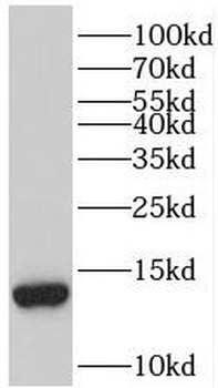 TBCA Antibody