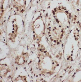 TBCA Rabbit Polyclonal Antibody