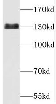 TBCD Antibody
