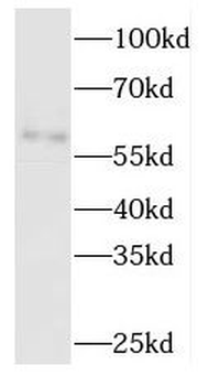 TBCE Rabbit Polyclonal Antibody