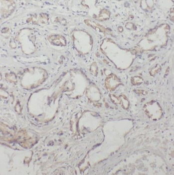 TBCE Rabbit Polyclonal Antibody