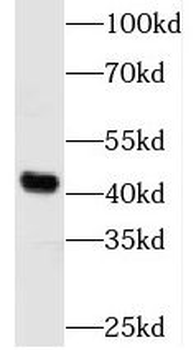 TBCEL Antibody