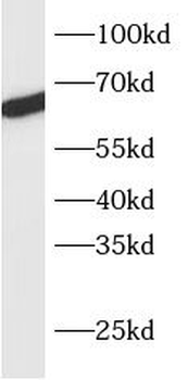TBX18 Antibody