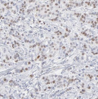 TBX18 Rabbit Polyclonal Antibody