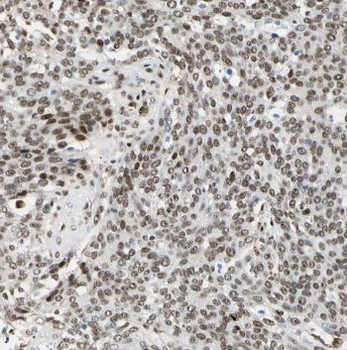 TCEAL7 Rabbit Polyclonal Antibody