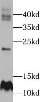 ELOC Rabbit Polyclonal Antibody