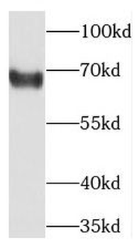 TCN1 Rabbit Polyclonal Antibody