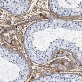TCN1 Rabbit Polyclonal Antibody
