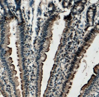 TCN2 Rabbit Polyclonal Antibody