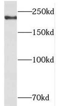 TCOF1 Rabbit Polyclonal Antibody