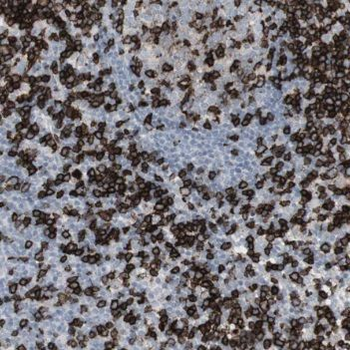 TCOF1 Rabbit Polyclonal Antibody