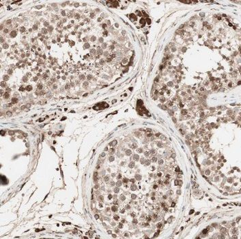 TCP10L Rabbit Polyclonal Antibody