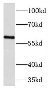 TCTN1 Antibody