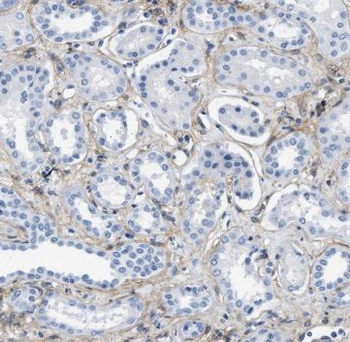 TCTN1 Rabbit Polyclonal Antibody
